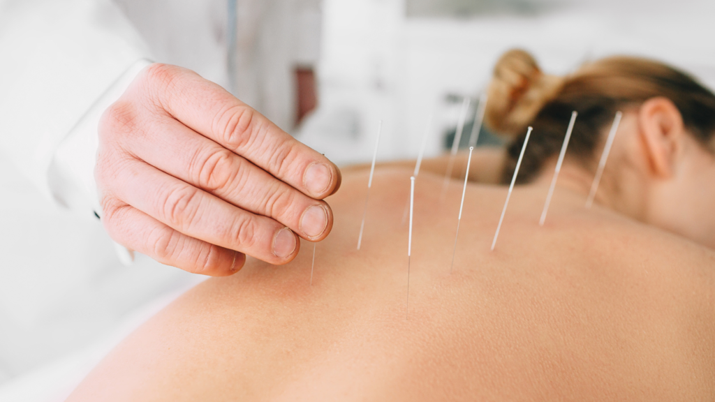 Tratamiento con acupuntura distal para aliviar el dolor en Rethinkea
